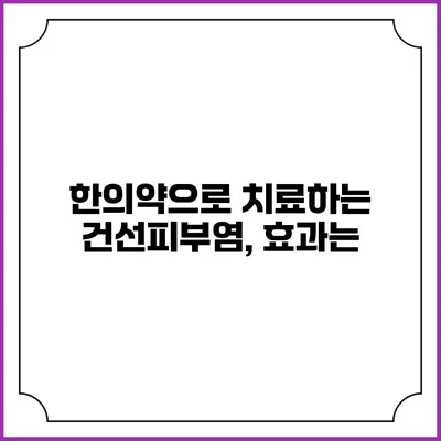 한의약으로 치료하는 건선피부염, 효과는?